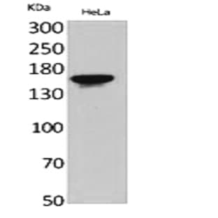 Jagged1 Polyclonal Antibody avatar