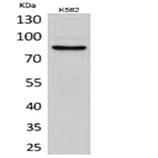 MMP-9 Polyclonal Antibody avatar