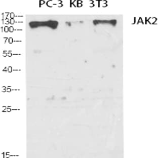 JAK2 Polyclonal Antibody avatar