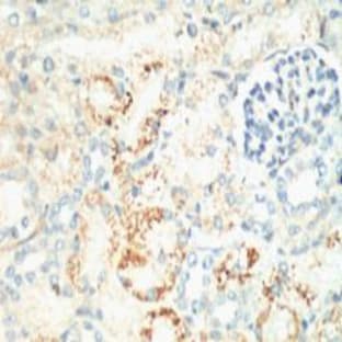 Ki 67 Monoclonal Antibody avatar