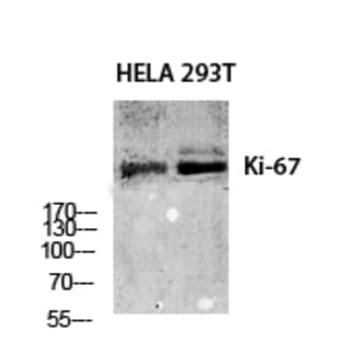Ki-67 Polyclonal Antibody avatar