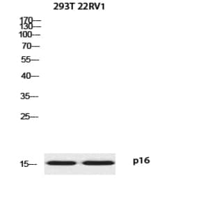 p16 Polyclonal Antibody avatar