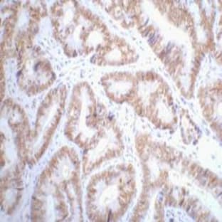 p53 Monoclonal Antibody avatar