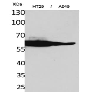 Catalase Polyclonal Antibody avatar