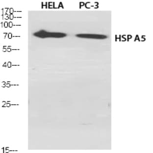 HSP A5 Polyclonal Antibody avatar