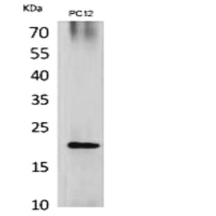 VEGF-B Polyclonal Antibody avatar
