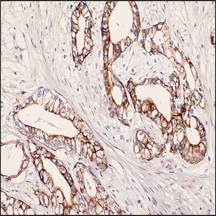 Anti - Cytokeratin 7