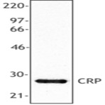 Purified anti-CRP (C-reactive protein)