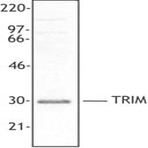 Purified anti-TRIM