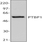 Purified anti-PTBP1