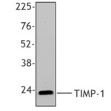 Purified anti-TIMP-1