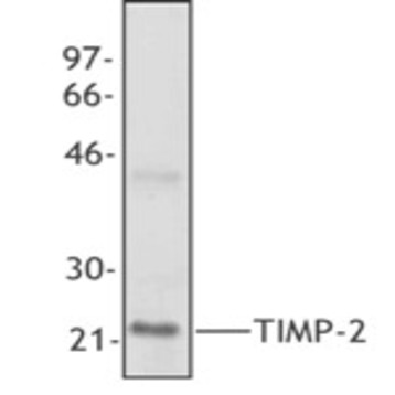 Purified anti-TIMP-2