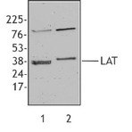 Purified anti-LAT