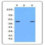 Purified anti-Ficolin B