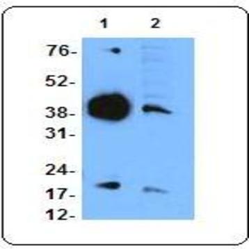 Purified anti-tartrate-resistant acid phosphatase (TRAcP)