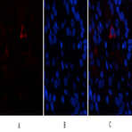 AR Polyclonal Antibody