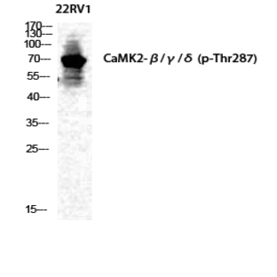 CaMKII?/?/? (phospho Thr287) Polyclonal Antibody