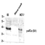 eIF2? (phospho Ser51) Polyclonal Antibody