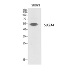 Glut4 Polyclonal Antibody