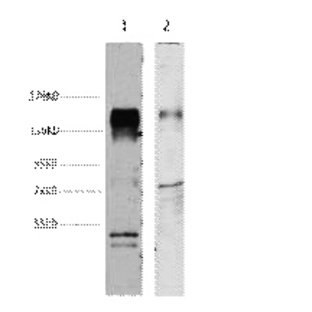 HER2 Monoclonal Antibody