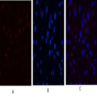 JAK3 Polyclonal Antibody