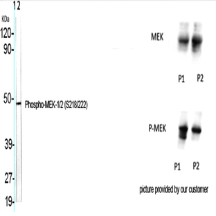 MEK-1/2 (phospho Ser218/222) Polyclonal Antibody