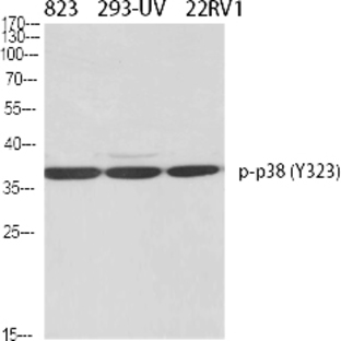 p38 (phospho Tyr323) Polyclonal Antibody