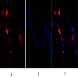 p38 Polyclonal Antibody