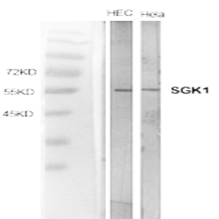 SGK1 Polyclonal Antibody