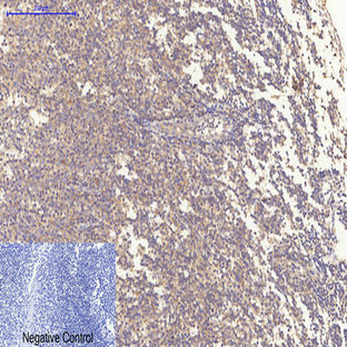 Bax Mouse Monoclonal Antibody(6F11)