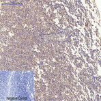 Bax Mouse Monoclonal Antibody(6F11)