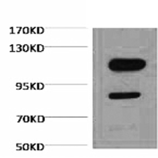 Cleaved PARP Monoclonal Antibody