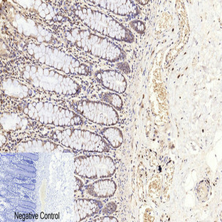 Cleaved-Caspase-3 p17 (D175) Polyclonal Antibody