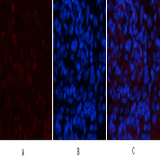 NBR1 Mouse Monoclonal Antibody(7C3)