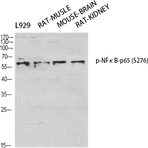 NF?B-p65 (phospho Ser276) Polyclonal Antibody