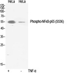 NF?B-p65 (phospho Ser536) Polyclonal Antibody