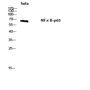 NF?B-p65 Polyclonal Antibody