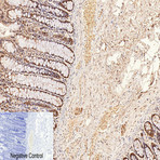 CD2 Monoclonal Antibody