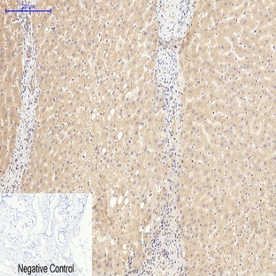 CD20 Monoclonal Antibody