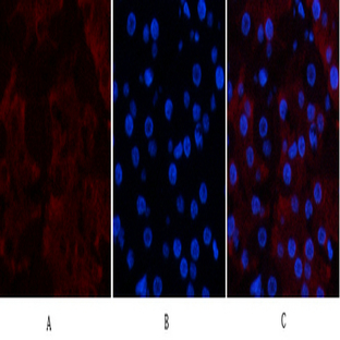 CD23 Monoclonal Antibody