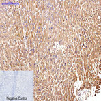 CD25 Monoclonal Antibody