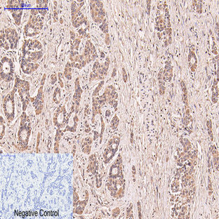 CD5 Monoclonal Antibody