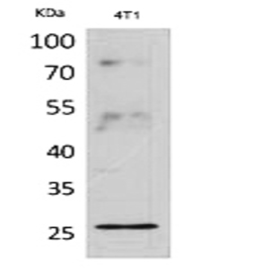 CD81 Polyclonal Antibody