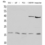 IL-1? Polyclonal Antibody