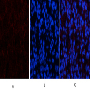 Amyloid-? Polyclonal Antibody