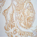 Galectin-3 Monoclonal Antibody