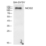 NOS2 Polyclonal Antibody