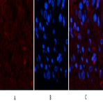 TTR Mouse Monoclonal Antibody(1D7)