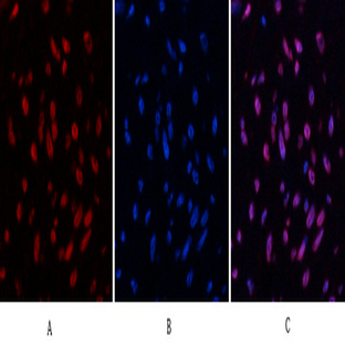 Desmin Monoclonal Antibody