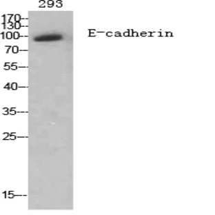 E-cadherin Polyclonal Antibody